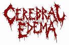 logo Cerebral Edema